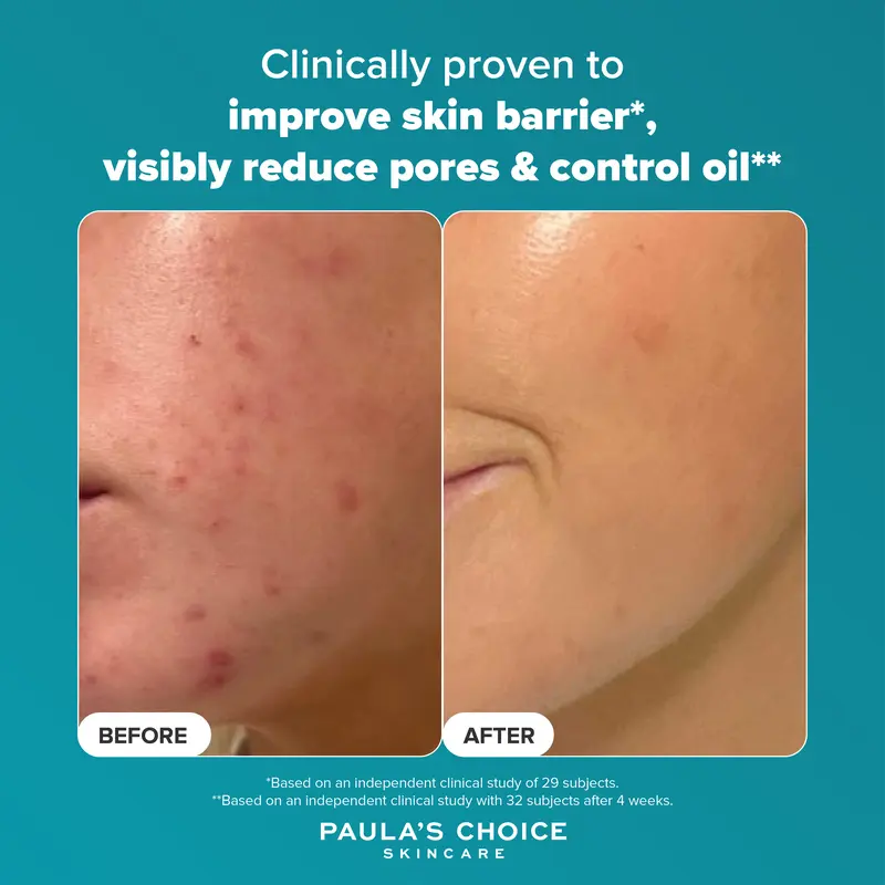 Paula's Choice SKIN PERFECTING 2% BHA Liquid Exfoliant - 118 ml 4