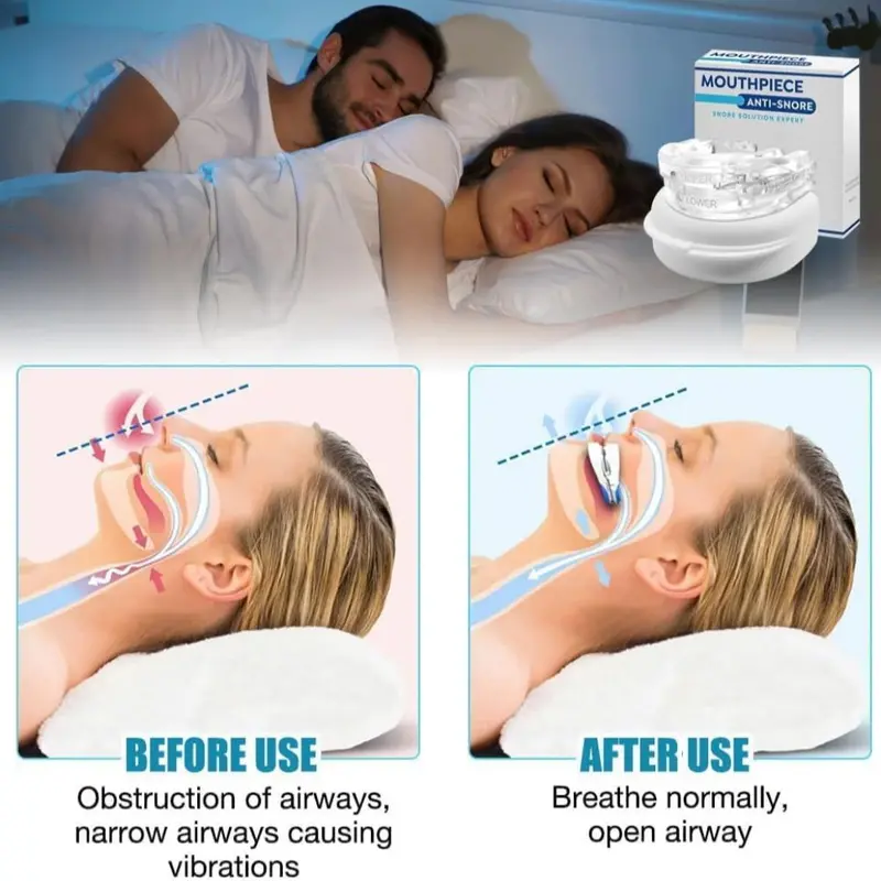 New Anti Snoring Devices, Snore Stopper Effectively Solves Sleep & Snoring, Adjustable Sleep Apnea Devices to Reduce Snoring and Sleep Apnoea, Adjustable Snoring Aids for Men/Women 3