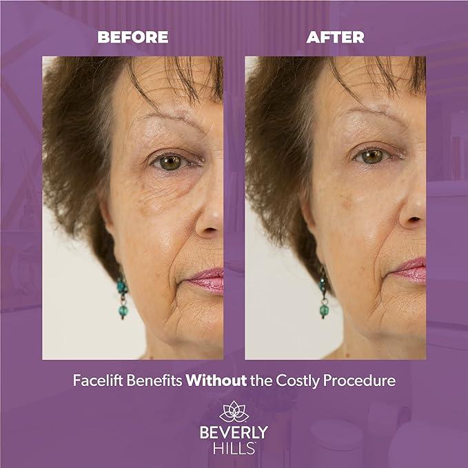 Instant Facelift Anti Aging Eye Serum Beverly Hills Treatment for Dark Circles, Puffy Eyes, Wrinkles, Under Eye Bags, Fine Lines, and Crows Feet that Works Within 90 Seconds | 30mL 2