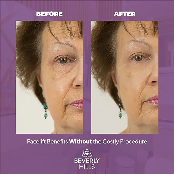 Instant Facelift Anti Aging Eye Serum Beverly Hills Treatment for Dark Circles, Puffy Eyes, Wrinkles, Under Eye Bags, Fine Lines, and Crows Feet that Works Within 90 Seconds | 30mL 2
