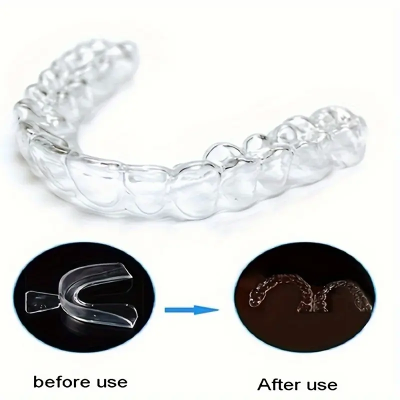 3pcs Sleep Better And Protect Your Teeth With A Dental Mouth Guard - Stop Grinding And Clenching Your Teeth At Night 2