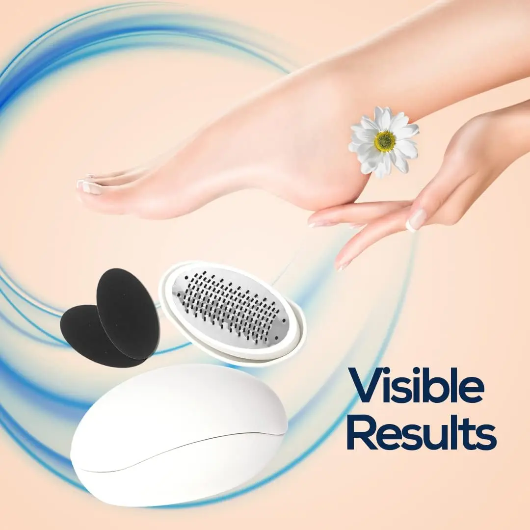 Egg Shaped Foot File for Soft and Smooth Feet - Personal Care Appliance - Masks Manicure Nail