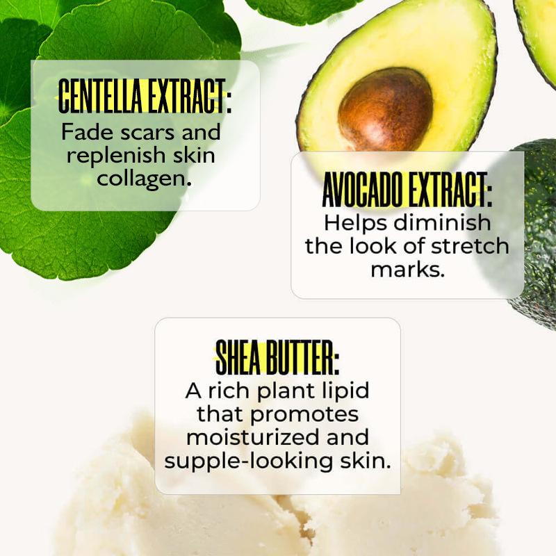 B-FLAT Clinically Proven Belly Firming Cream for Stretch Marks And Loose Skin - With Avocado Extract 2