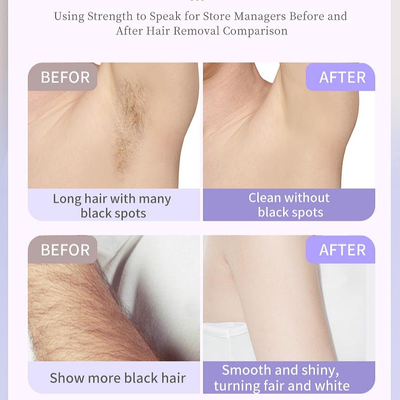 Double headed private hair shaver for women, comfortable electric hair removal knife, waterproof, full body private hair shaver, no black spot armpit hair removal device, a must-have tool for both men and women 1