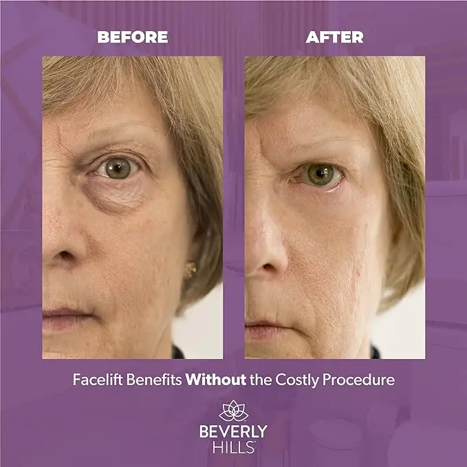 Instant Facelift Anti Aging Eye Serum Beverly Hills Treatment for Dark Circles, Puffy Eyes, Wrinkles, Under Eye Bags, Fine Lines, and Crows Feet that Works Within 90 Seconds | 30mL 4