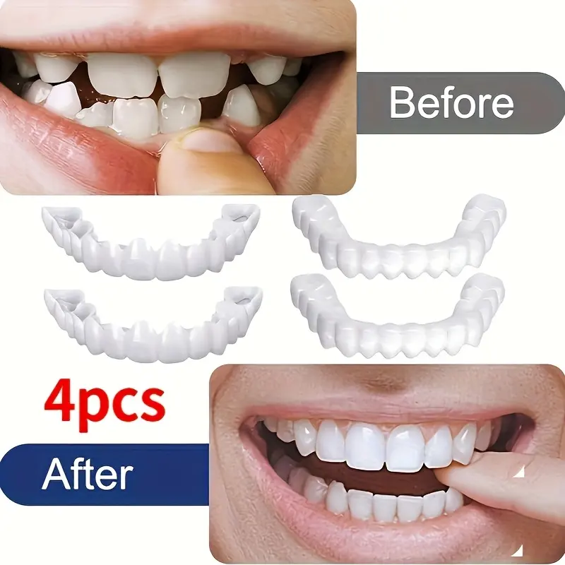4pcs Professional Dental Veneers - Comfortable, Easy-Clean White Dentures for Casual Attire, Accessories